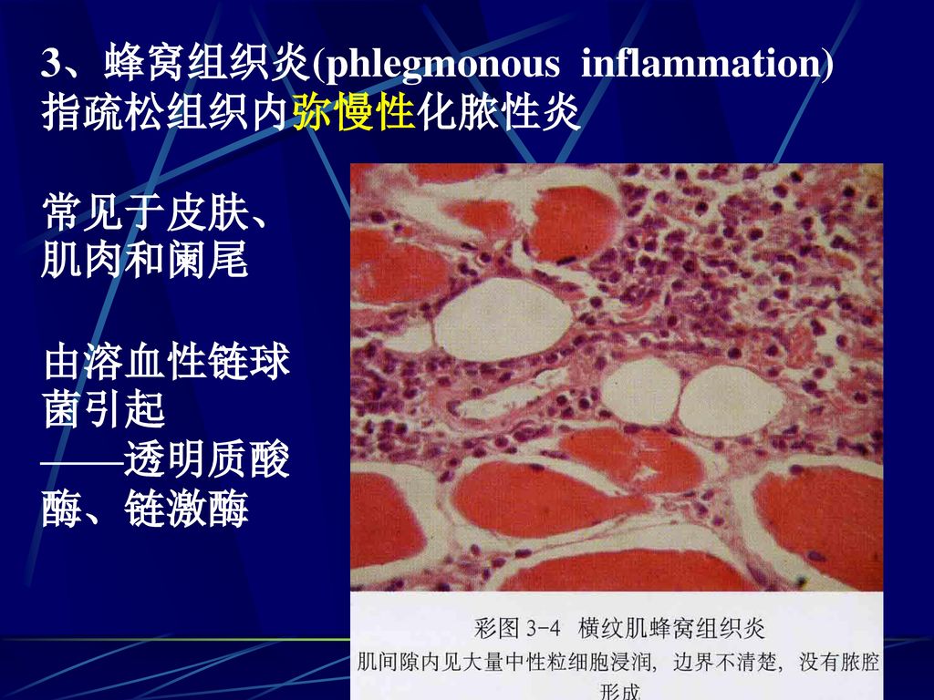 presentation on theme"第四节 炎症的临床表现 一,炎症的局部表现